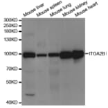 Western blot - ITGA2B Antibody from Signalway Antibody (32970) - Antibodies.com
