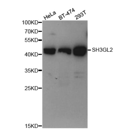 Western blot - SH3GL2 Antibody from Signalway Antibody (32985) - Antibodies.com