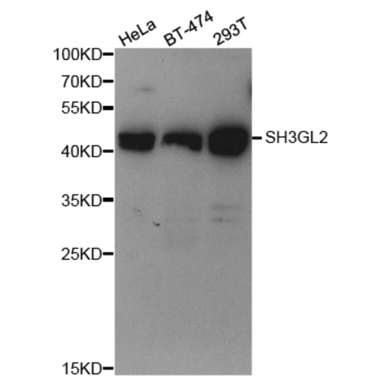 Western blot - SH3GL2 Antibody from Signalway Antibody (32985) - Antibodies.com