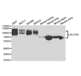 Western blot - SLC3A2 Antibody from Signalway Antibody (32986) - Antibodies.com