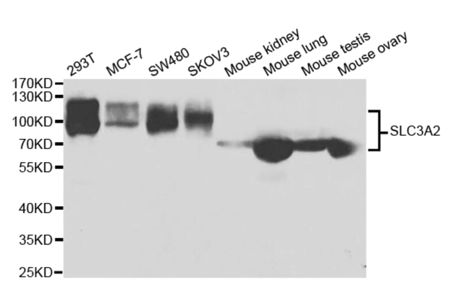 Western blot - SLC3A2 Antibody from Signalway Antibody (32986) - Antibodies.com