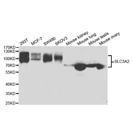 Western blot - SLC3A2 Antibody from Signalway Antibody (32986) - Antibodies.com