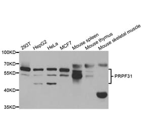 Western blot - PRPF31 Antibody from Signalway Antibody (32999) - Antibodies.com