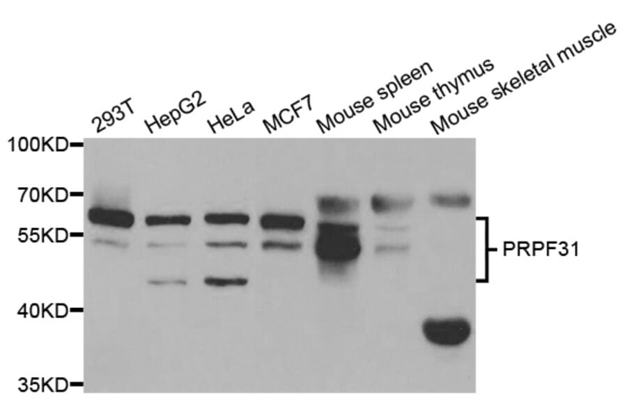 Western blot - PRPF31 Antibody from Signalway Antibody (32999) - Antibodies.com