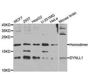 Western blot - DYNLL1 Antibody from Signalway Antibody (33008) - Antibodies.com