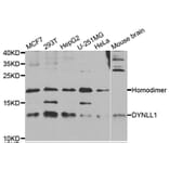 Western blot - DYNLL1 Antibody from Signalway Antibody (33008) - Antibodies.com