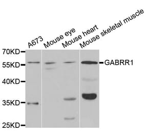 Western blot - GABRR1 Antibody from Signalway Antibody (33011) - Antibodies.com