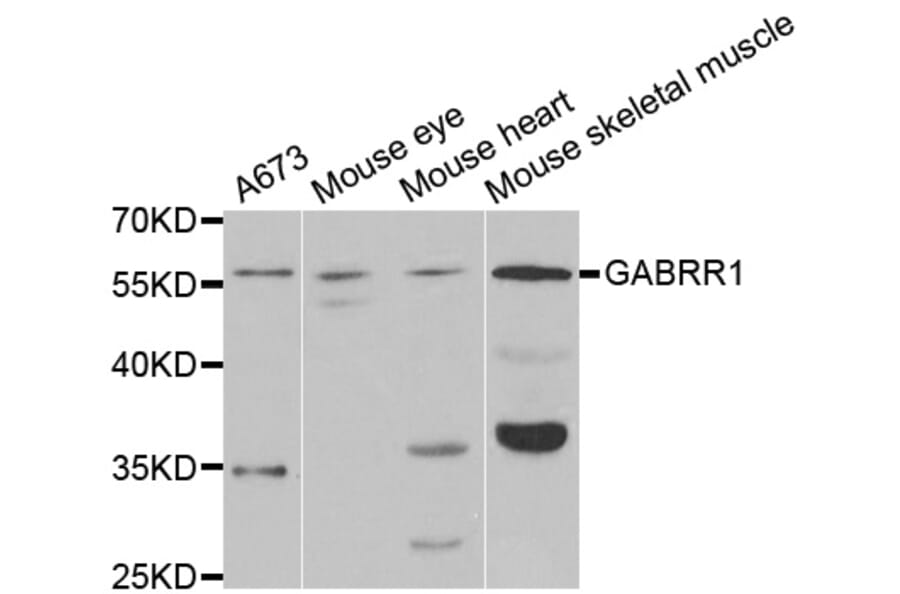 Western blot - GABRR1 Antibody from Signalway Antibody (33011) - Antibodies.com