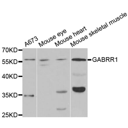 Western blot - GABRR1 Antibody from Signalway Antibody (33011) - Antibodies.com