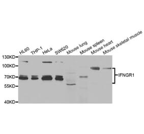 Western blot - IFNGR1 Antibody from Signalway Antibody (33013) - Antibodies.com