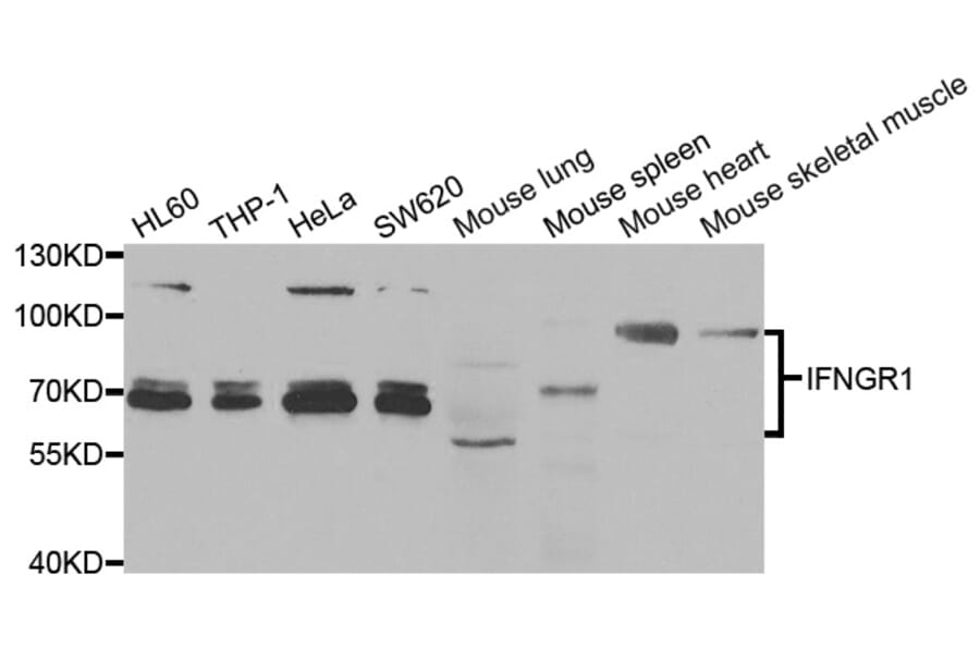 Western blot - IFNGR1 Antibody from Signalway Antibody (33013) - Antibodies.com