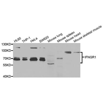 Western blot - IFNGR1 Antibody from Signalway Antibody (33013) - Antibodies.com