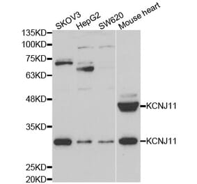 Western blot - KCNJ11 Antibody from Signalway Antibody (33027) - Antibodies.com