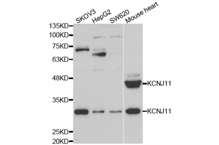 Western blot - KCNJ11 Antibody from Signalway Antibody (33027) - Antibodies.com