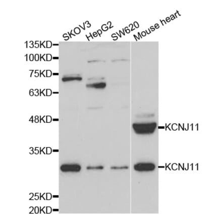 Western blot - KCNJ11 Antibody from Signalway Antibody (33027) - Antibodies.com