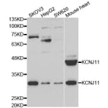 Western blot - KCNJ11 Antibody from Signalway Antibody (33027) - Antibodies.com