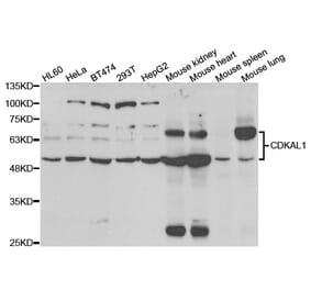 Western blot - CDKAL1 Antibody from Signalway Antibody (33033) - Antibodies.com