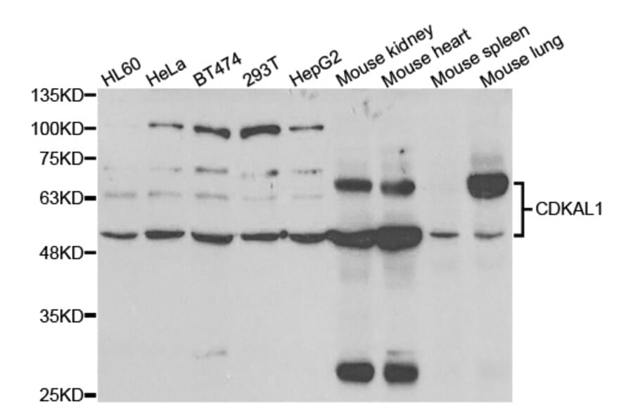 Western blot - CDKAL1 Antibody from Signalway Antibody (33033) - Antibodies.com