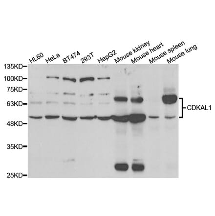 Western blot - CDKAL1 Antibody from Signalway Antibody (33033) - Antibodies.com
