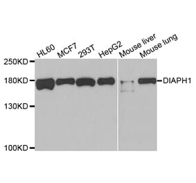 Western blot - DIAPH1 Antibody from Signalway Antibody (33034) - Antibodies.com