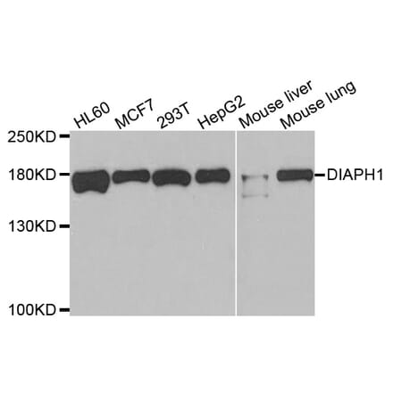 Western blot - DIAPH1 Antibody from Signalway Antibody (33034) - Antibodies.com