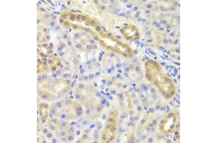 Immunohistochemistry - DIAPH1 Antibody from Signalway Antibody (33034) - Antibodies.com