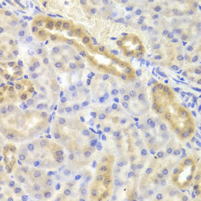 Immunohistochemistry - DIAPH1 Antibody from Signalway Antibody (33034) - Antibodies.com