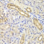Immunohistochemistry - DIAPH1 Antibody from Signalway Antibody (33034) - Antibodies.com