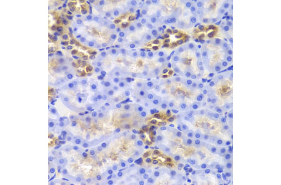 Immunohistochemistry - DIAPH1 Antibody from Signalway Antibody (33034) - Antibodies.com