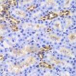 Immunohistochemistry - DIAPH1 Antibody from Signalway Antibody (33034) - Antibodies.com