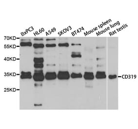 Western blot - SLAMF7 Antibody from Signalway Antibody (33044) - Antibodies.com