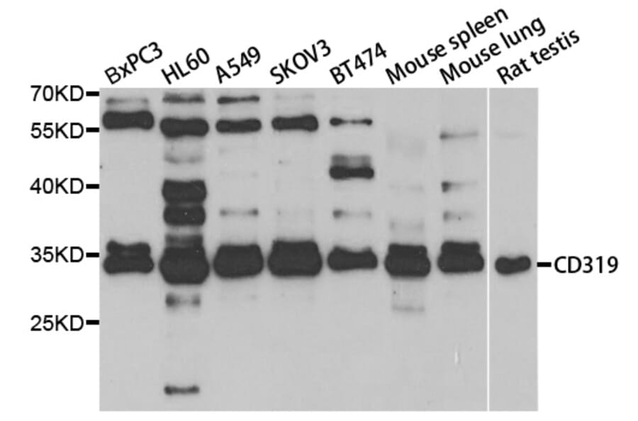 Western blot - SLAMF7 Antibody from Signalway Antibody (33044) - Antibodies.com