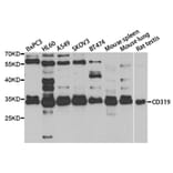 Western blot - SLAMF7 Antibody from Signalway Antibody (33044) - Antibodies.com