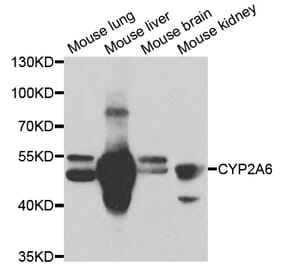Western blot - CYP2A6 Antibody from Signalway Antibody (33062) - Antibodies.com