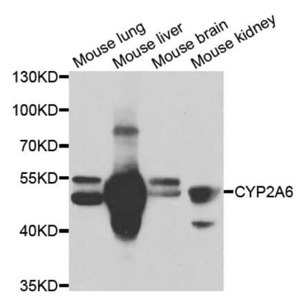 Western blot - CYP2A6 Antibody from Signalway Antibody (33062) - Antibodies.com