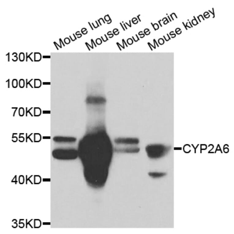 Western blot - CYP2A6 Antibody from Signalway Antibody (33062) - Antibodies.com