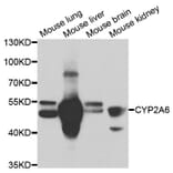 Western blot - CYP2A6 Antibody from Signalway Antibody (33062) - Antibodies.com