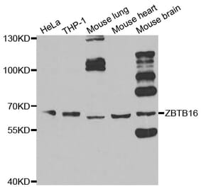 Western blot - ZBTB16 Antibody from Signalway Antibody (33100) - Antibodies.com