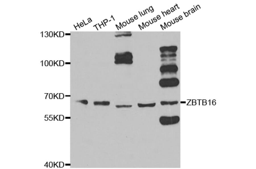 Western blot - ZBTB16 Antibody from Signalway Antibody (33100) - Antibodies.com