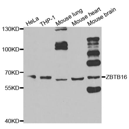 Western blot - ZBTB16 Antibody from Signalway Antibody (33100) - Antibodies.com