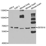Western blot - ZBTB16 Antibody from Signalway Antibody (33100) - Antibodies.com