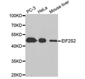 Western blot - EIF2S2 Antibody from Signalway Antibody (33102) - Antibodies.com