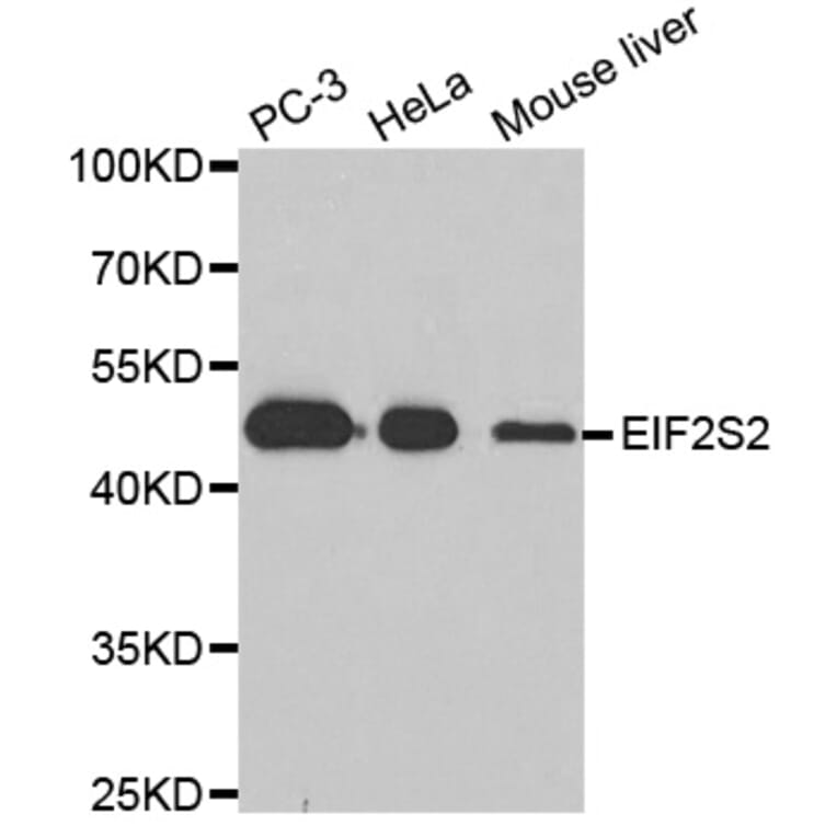 Western blot - EIF2S2 Antibody from Signalway Antibody (33102) - Antibodies.com