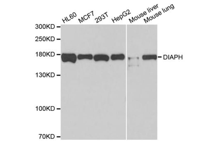 Western blot - DIAPH1 Antibody from Signalway Antibody (33105) - Antibodies.com