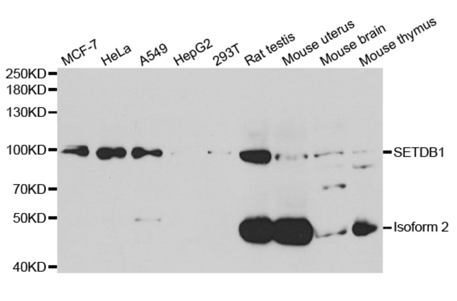 Western blot - SETDB1 Antibody from Signalway Antibody (33107) - Antibodies.com
