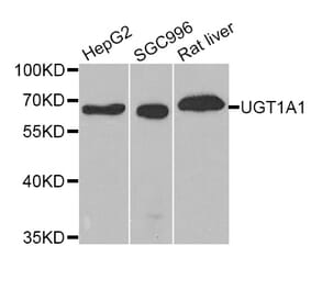 Western blot - UGT1A1 Antibody from Signalway Antibody (33110) - Antibodies.com