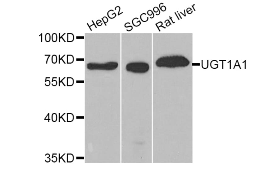 Western blot - UGT1A1 Antibody from Signalway Antibody (33110) - Antibodies.com