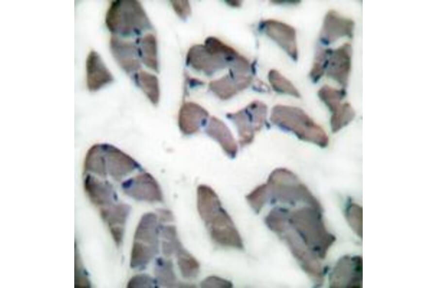 Immunohistochemistry - Desmin Antibody from Signalway Antibody (33355) - Antibodies.com