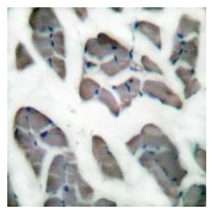 Immunohistochemistry - Desmin Antibody from Signalway Antibody (33355) - Antibodies.com