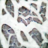 Immunohistochemistry - Desmin Antibody from Signalway Antibody (33355) - Antibodies.com